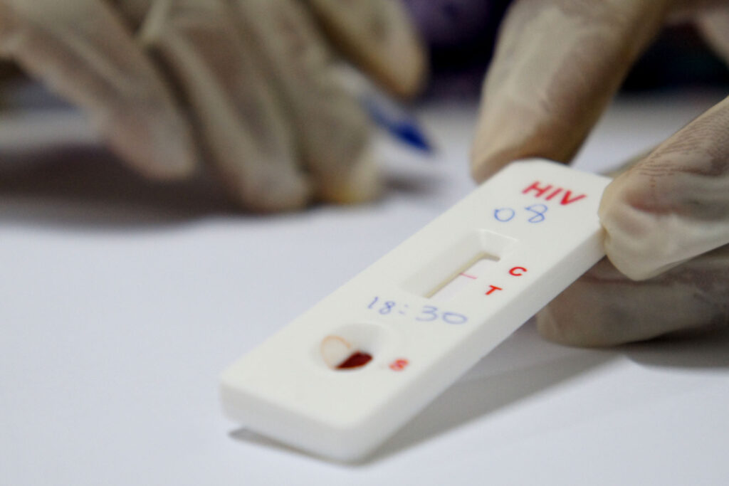 Justiça suspende exigência de exame de HIV em concurso público de Foz do Iguaçu