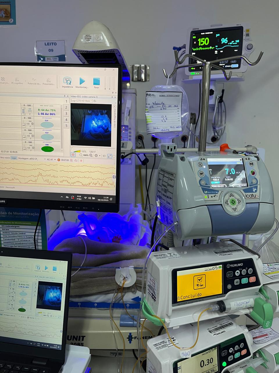 Hospital Regional de Francisco Beltrão adota tecnologia inédita para monitoramento de recém-nascidos
